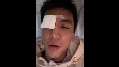 开云网页版-郭艾伦眼部重伤缝针40余次：不知道这次会不会瞎了